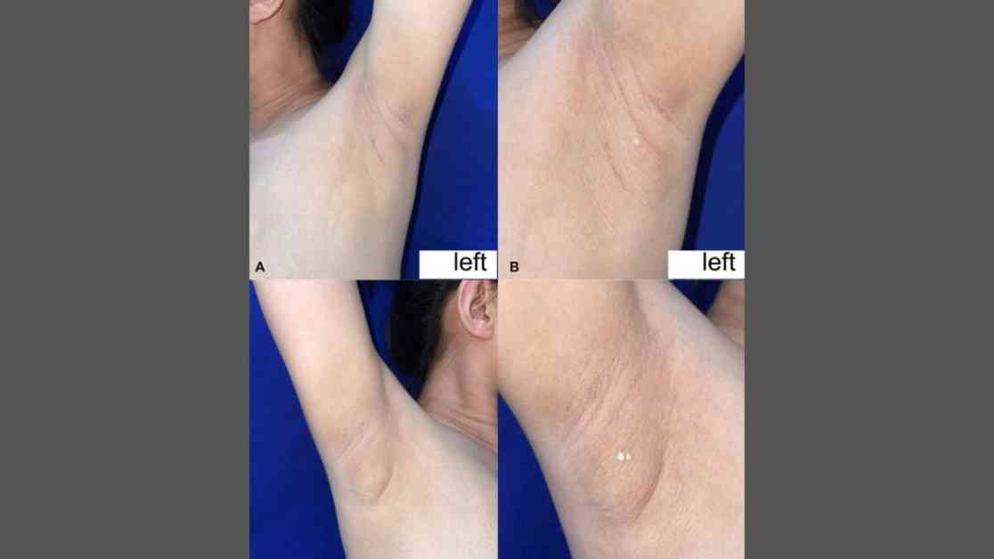 Kadının Sıra Dışı Durumu: Süt Sızdıran Koltuk Altı kadnn-sra-d-durumu-st-szdran-koltuk-alt